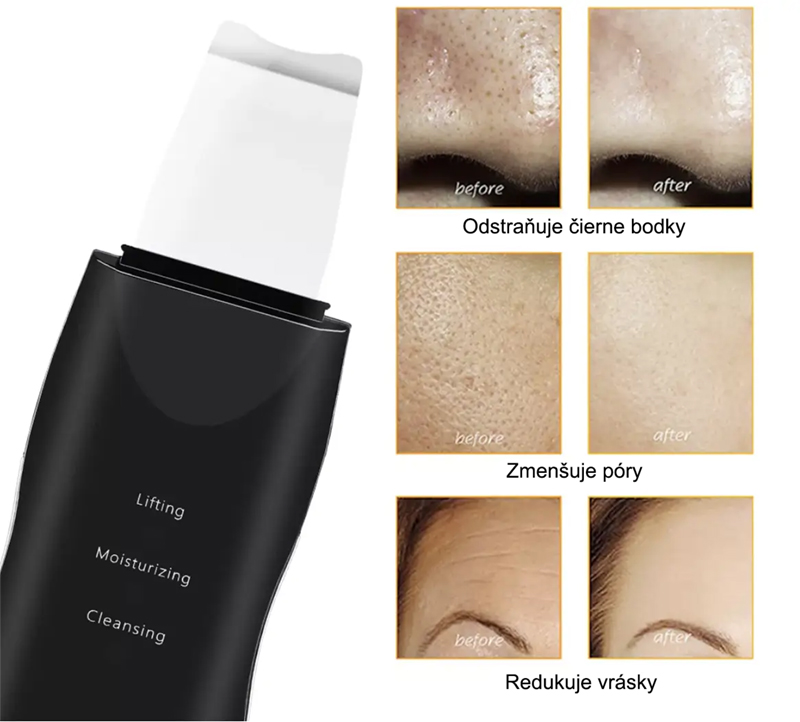 Sonic Hailitech Ultrazvukový čistič na omladenie pleti