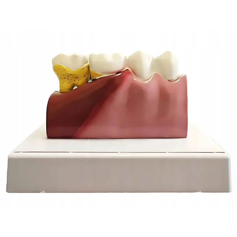 Anatomický model zubov na štúdium