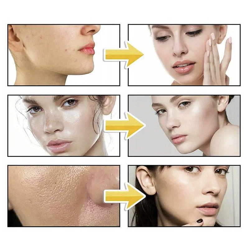 Soraya I Love Serum hydratačné pleťové sérum 30 ml
