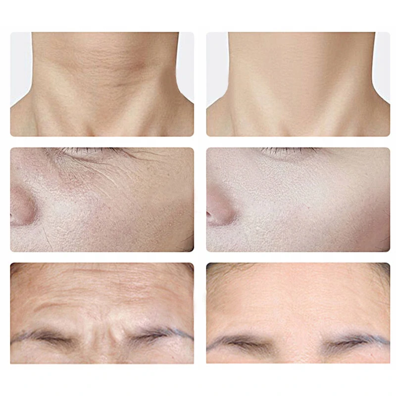 Ultrazvukový relaxačný masážny prístroj na krk a tvár EMS lifting 3v1 biely