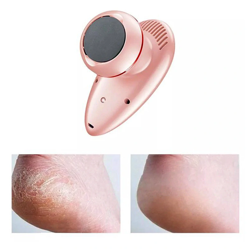 MARSKE MS007 - Elektrická brúska na pedikúru a masažér 2v1