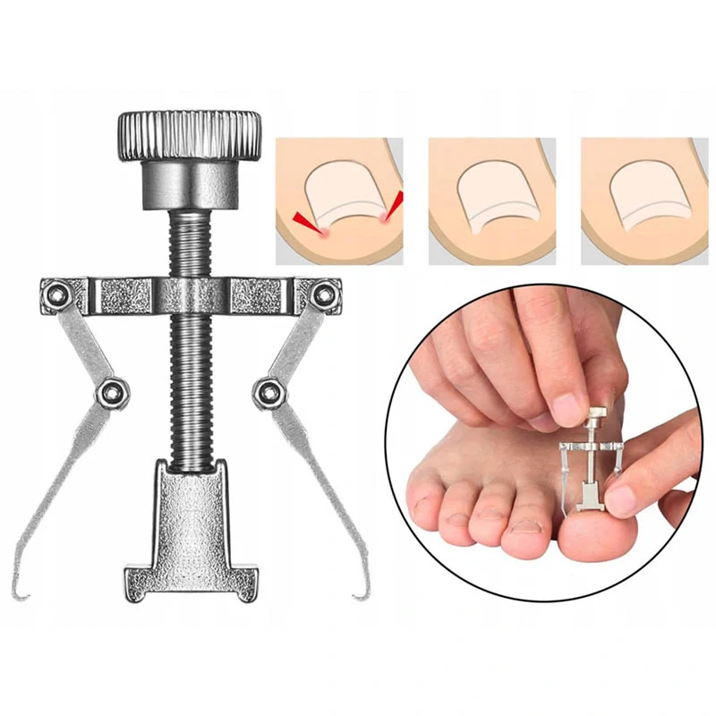 Súprava na zarastajúce nechty