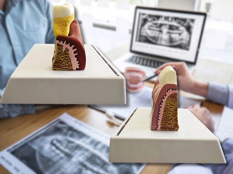 Anatomický model zubov na štúdium
